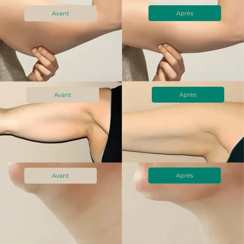 Lynae – Lymphdrainage