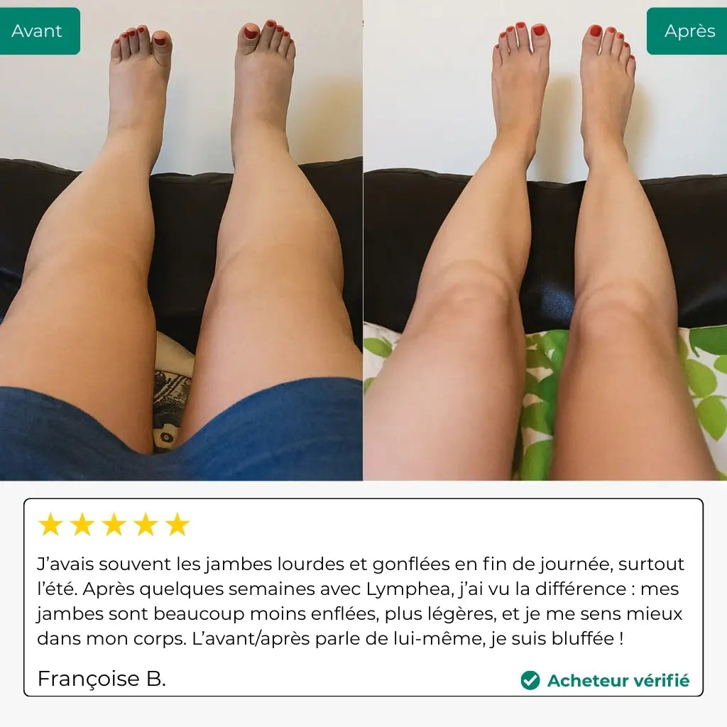 Lynae – Lymphdrainage