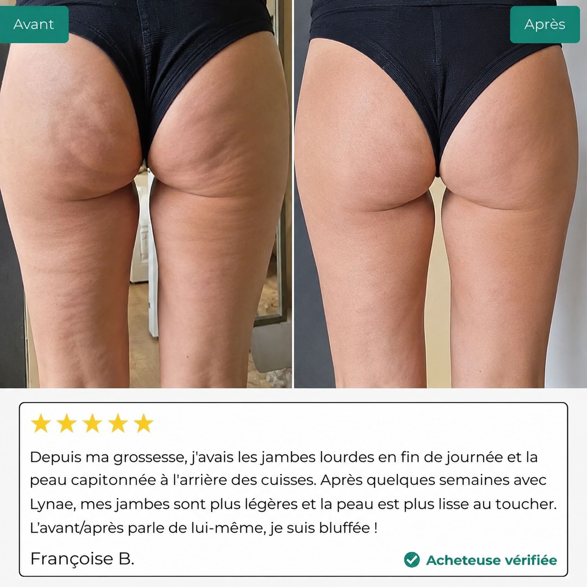 Lynae - Drainant Lymphatique - Cellulite